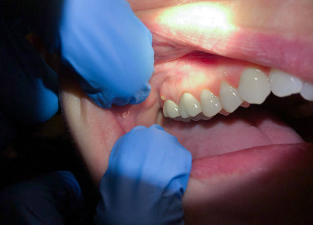 Best Emergency Dental Surgery in Angola, IN