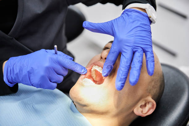 Best Emergency Tooth Extraction in Angola, IN